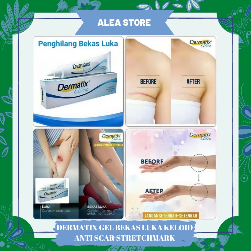 Dermatix Ultra Gel 15g Penghilang Bekas Luka / Keloid ANTI SCAR Stretchmark 15 Gram Dermatik Original