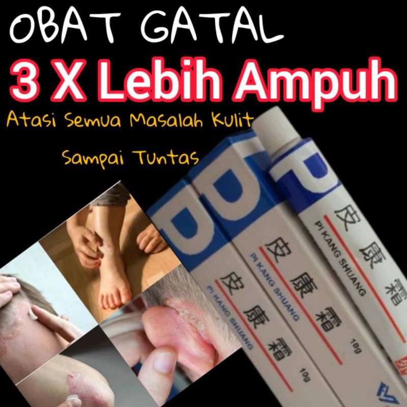 SALEP GATAL Selangkangan Ketiak Sela Jari Infeksi Jamur Kurap Alergi