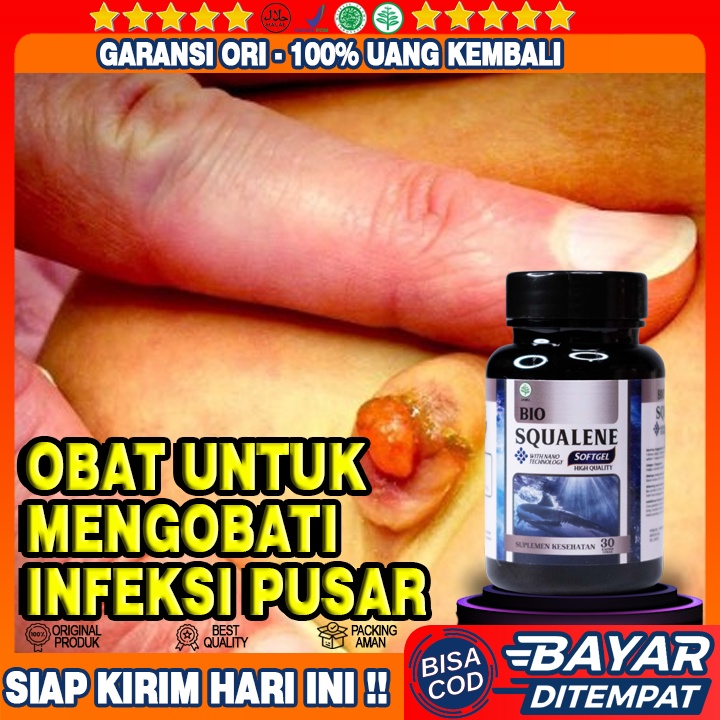 Obat Tradisional Infeksi Pusar - Obat Pusar Gatal-gatal - Obat Granuloma Umbikalis - Obat Pusar Beer