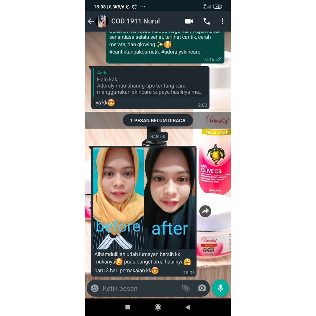 [1 PAKET] ADORALY (Bonus TUMBLER dan POUCH) -SKINCARE BPOM, GLOWING, ANTI JERAWAT, FLEX HITAM, KUSAM-3