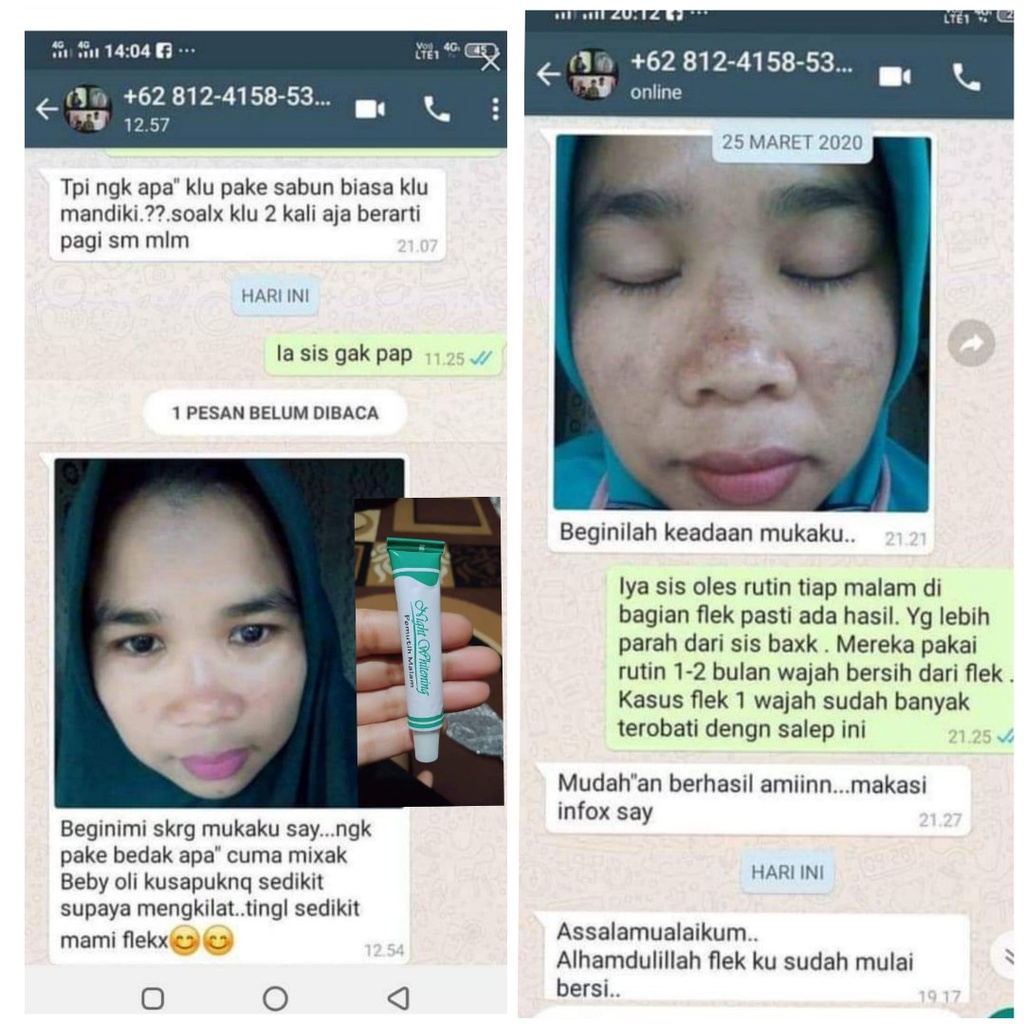 Night Whitening Salep Penghilang Flek Hitam / Cream Penghilang Flek Hitam Membandel /Cream Pemutih Kulit Dan Wajah Ampuh Original