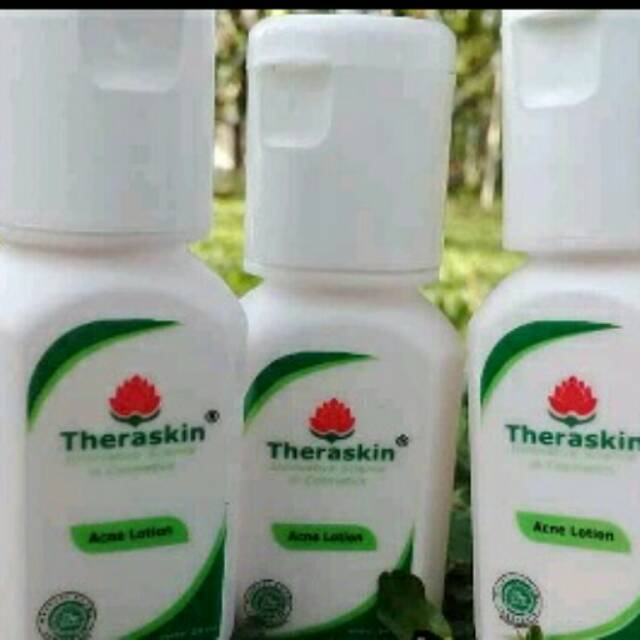 Acne lotion theraskin