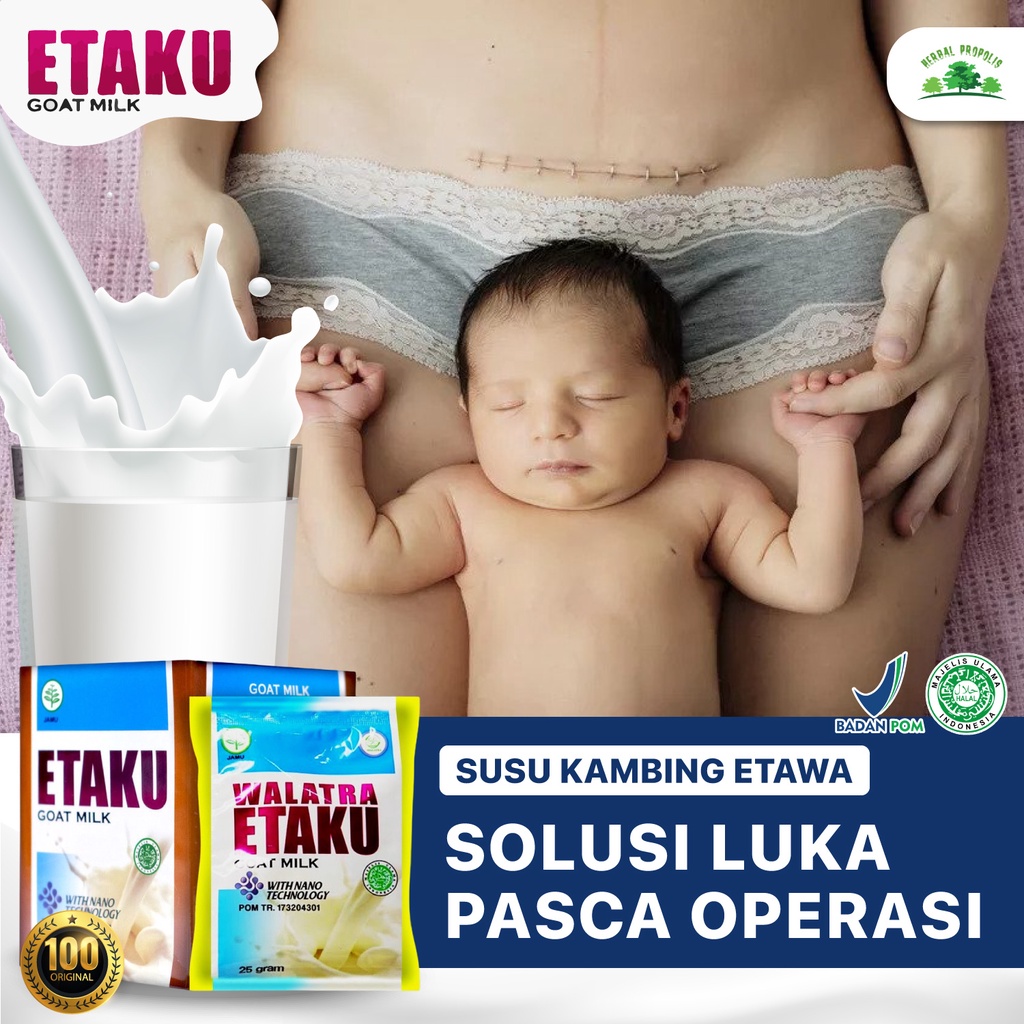 

Susu Kambing Pengering Luka Caesar Obat Jahitan Pasca Operasi Penambah Albumin Tingkatkan Daya Tahan Tubuh Walatra Etaku Goat Milk Asli 100%