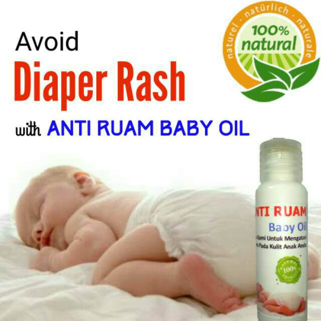 Jual Cod Minyak Ruam Popok Bayi Baby Oil Diaper Rash Cream Cream Ruam Popok Krim Ruam Popok Bayi Indonesia Shopee Indonesia