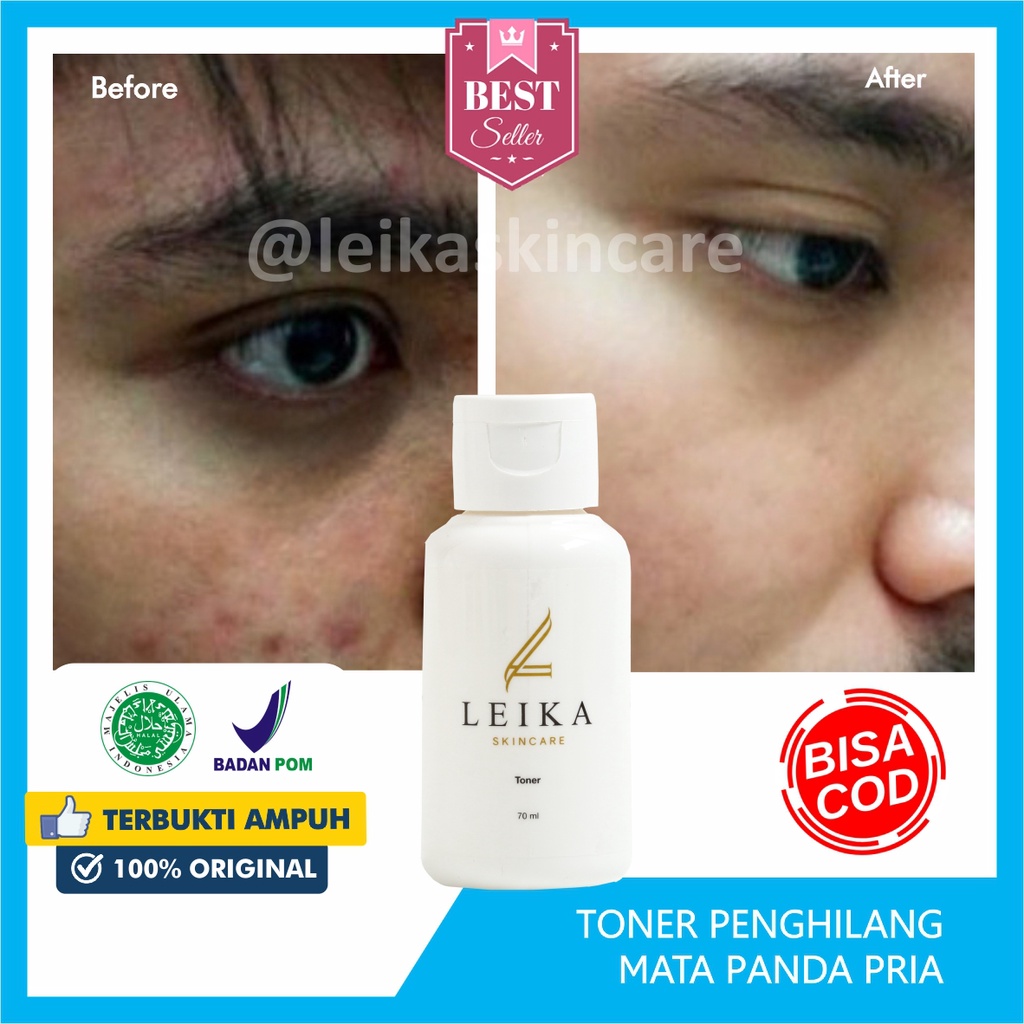 TerlarisToner Penghilang Mata Panda Pria Bpom Ampuh Menghilangkan Mata Panda penghilang mata panda a