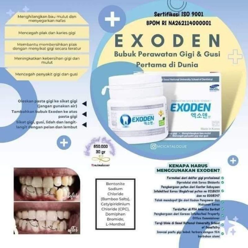 Exoden pemutih gigi MCI