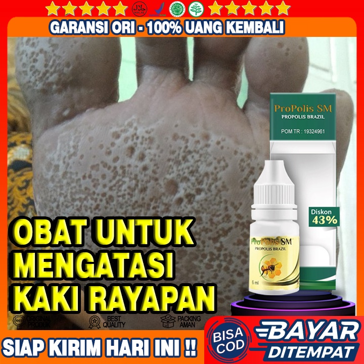 Obat Kaki Rayapan, Kaki Pecah, Kaki Bolong Bolong, Pitted Keratolisis, Kaki Bolong Berlubang Dan Bau