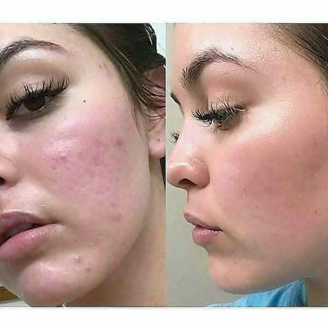 240ML The ordinary Glycolic Acid 7% Toning Solution toner