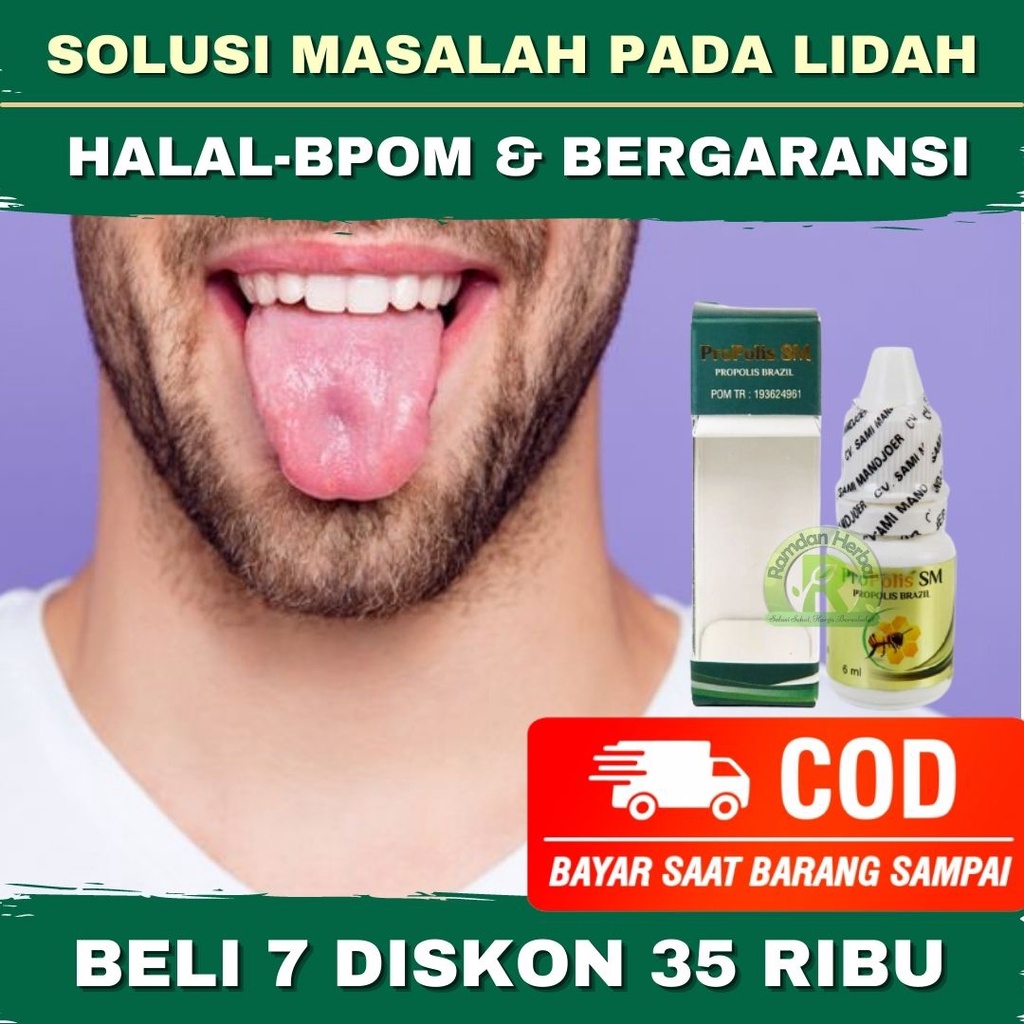 Obat Lidah Tidak Ada Rasa Lidah Sariawan Lidah Putih Lidah Mati Rasa Obat Lidah Hambar Infeksi Lidah