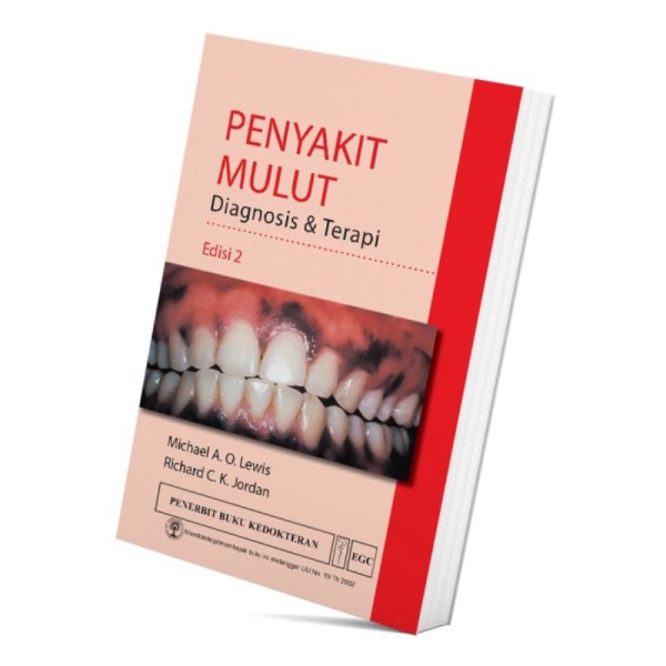 Buku Kedokteran EGC Penyakit Mulut Diagnosis  Terapi Edisi 2