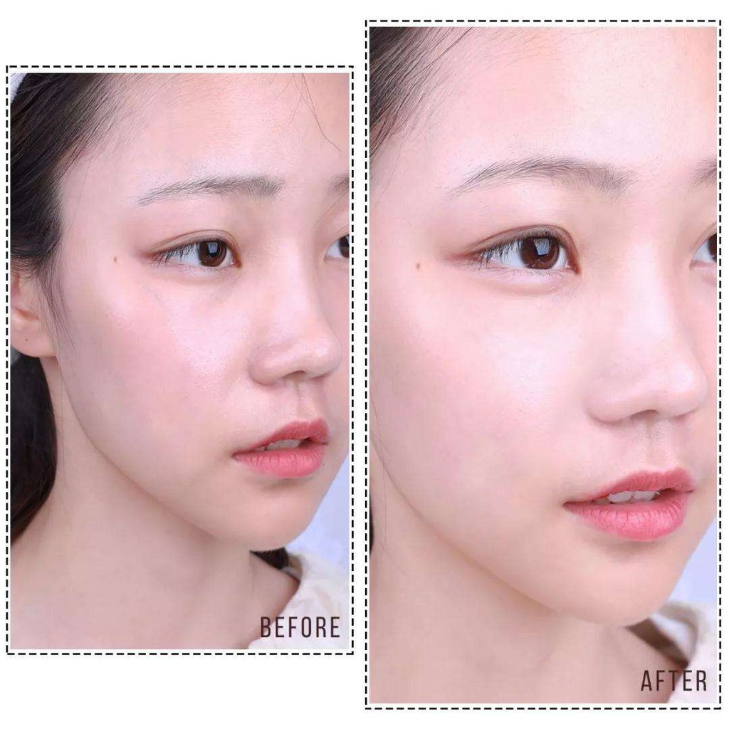 ✅100% ORIGINAL JEUNE FEN Hyaluronic Acid and Niacinamide Moisturizing whitening mask