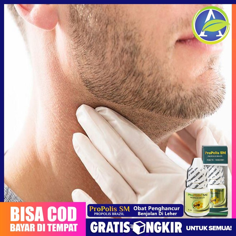Obat Penghancur Benjolan di Leher, Kelenjar Tiroit, Teroid, PROPOLIS SM BRAZIL Original Tasikmalaya