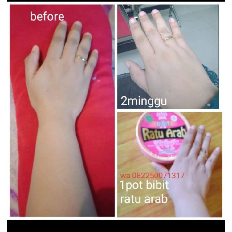 BIBIT RATU ARAB/BIBIT PEMUTIH/PEMUTIH BADAN/PENGHILANG STRECHMARK , BPOM , ASLI