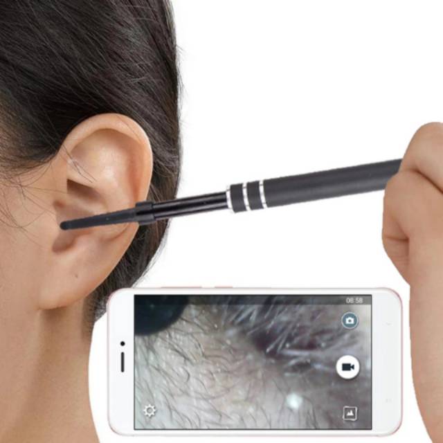 NA - Pembersih Telinga Anak Kamera - Ear Cleaning Endoscope