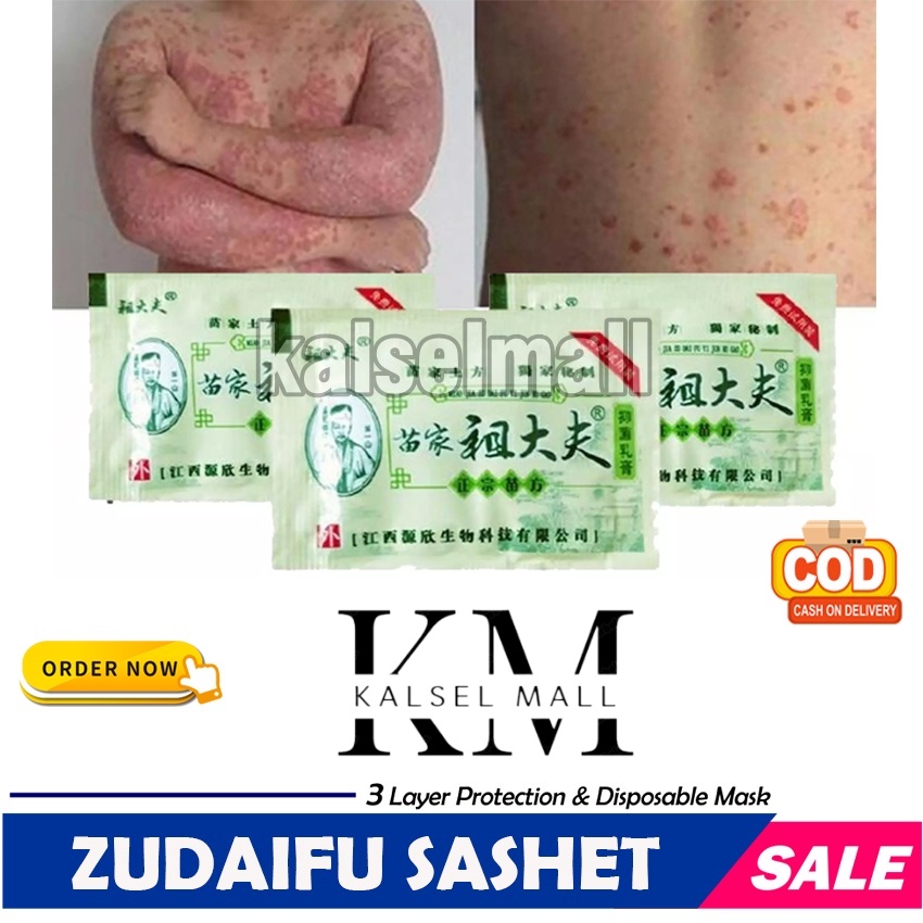 SALEP KRIM GATAL OBAT SALAP 100% ORIGINAL ZUDAIFU UNTUK SEMUA GATAL GATALAN SACHET ALERGI KULIT JAMURAN JERAWAT EKSIM PSOARISIS KUDIS PANU KURAP PANUAN SKABIES HERBAL EKSIM JAMUR KUTU AIR KEPUTIHAN SELANGKANGAN HERPES OBAT CINA ZHUDAIFU AMPUH ZUDAIPU OC2