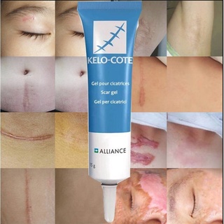 Salep Pengering Luka Bekas Operasi Scar Keloid