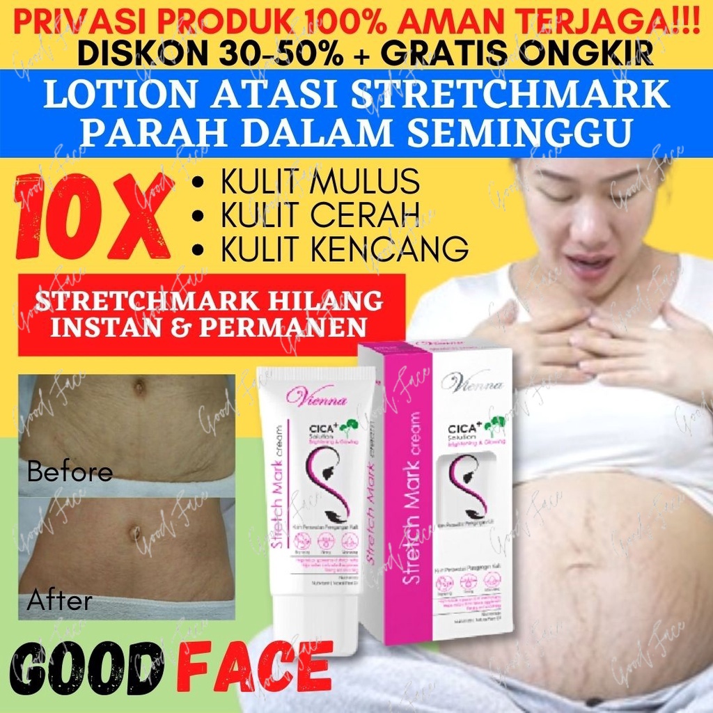 PENGHILANG STRECHMARK VIENNA STRETCH MARK CREAM  STRETCH MARK CREAM STRETCHMARK CREAM