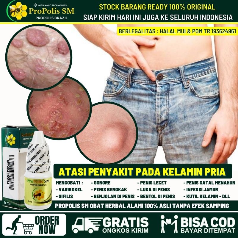 AMAN BPOM - Salep Penghilang Benjolan Abnormal di Penis 100% Alami, Obat Benjolan di Penis, Borok di