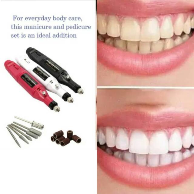 Drill Gigi dental perata lem veneer curling bor mini behel