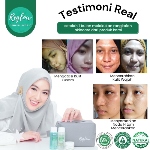 Skincare Reglow Doctor Shindy Putri Paket Acne Untuk Kulit Berminyak Berjerawat Bruntusan Pori Besar Wajah Glowing Penghilang Noda Hitam Komedo Milia Untuk Kulit Kering Sensitif Red glow Ori Official Store