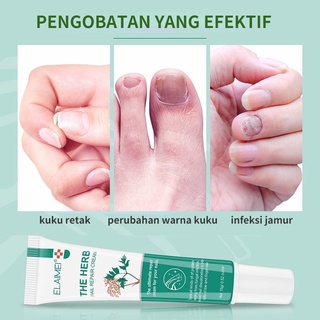 Jual Serum Kuku Krim Perbaikan Kuku Herbal Obat Kuku Jamur Dan Rusak ...