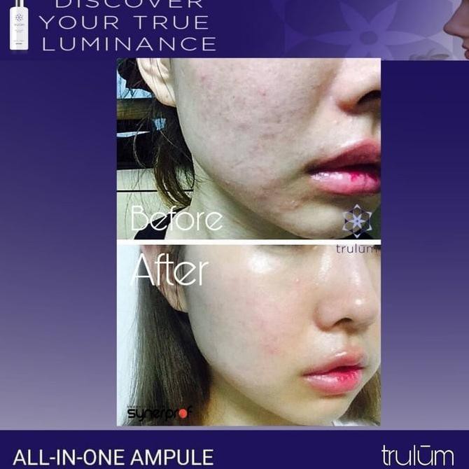 [[BISA COD]] Krim Wajah Pria Wanita Cream Untuk Flek Hitam Penghilang Bekas Jerawat