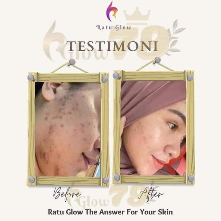Ratu Glow Skincare BPOM Viral PAKET CREAM WAJAH Glowing series Paket Normal Flek Jerawat bopeng |skincare pelicin wajah-8