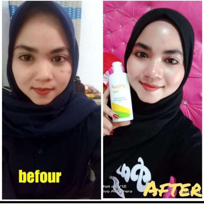 N'GLOW SKINCARE ORIGINAL