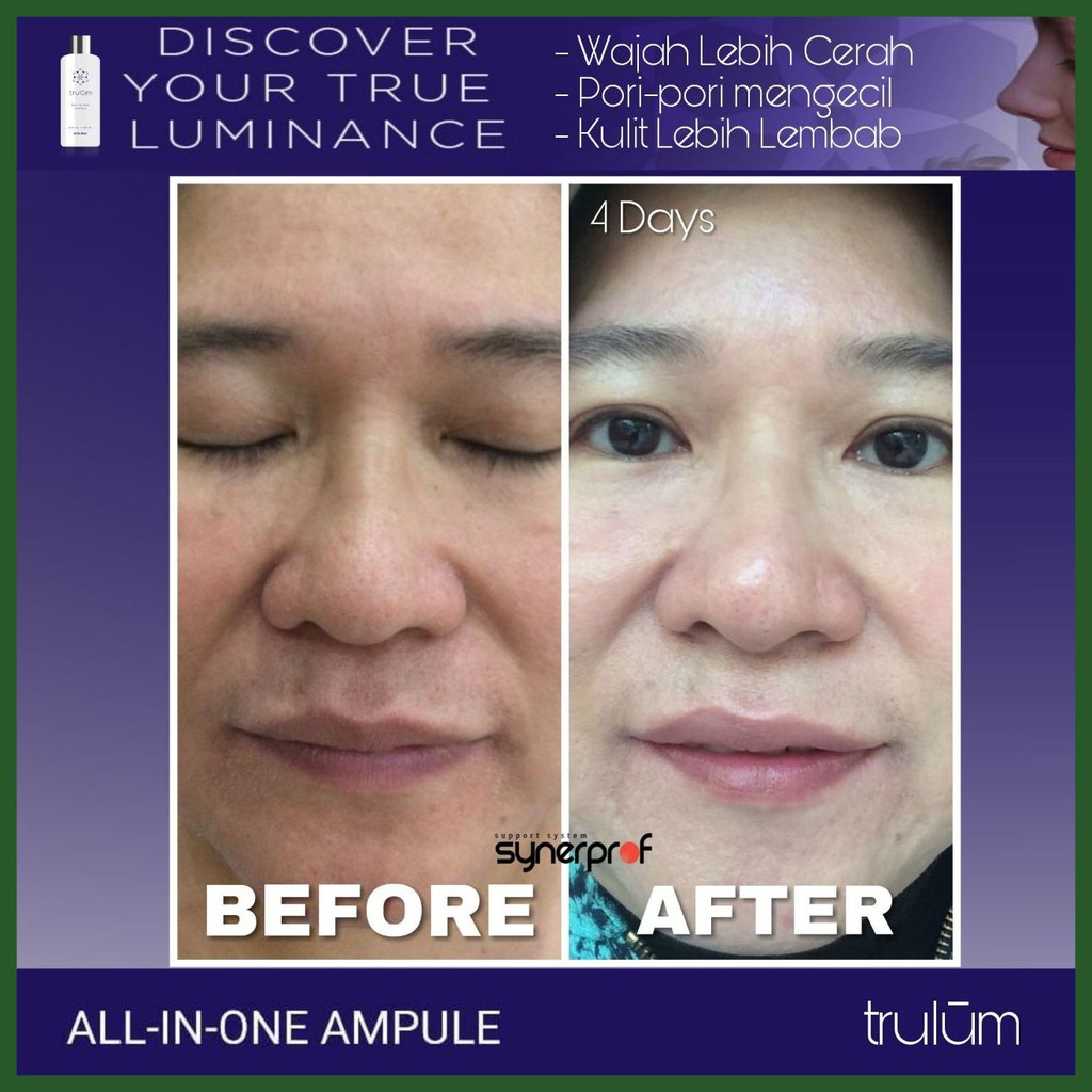 Krim Wajah Pria Wanita Cream Untuk Flek Hitam Penghilang Bekas Jerawat