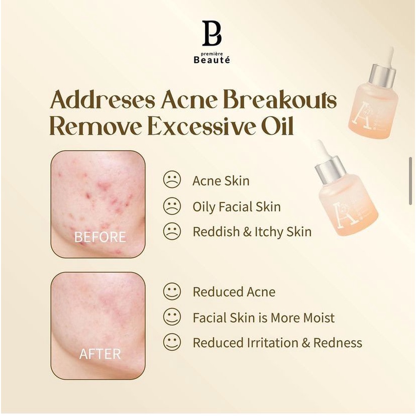 [ORI] Premiere Beaute Acne Care Serum dengan Kandungan AHA + BHA Formula Khusus Perawatan Kulit Wajah Berjerawat