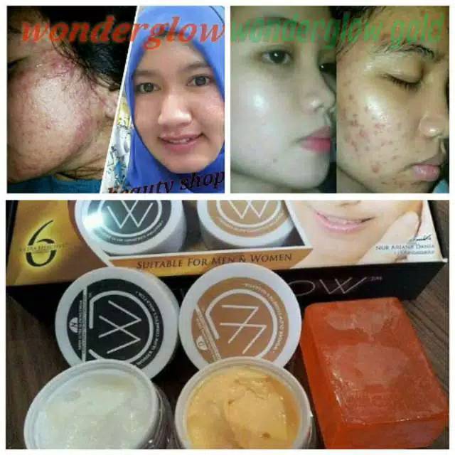 Cream siang malam wonder glow gold