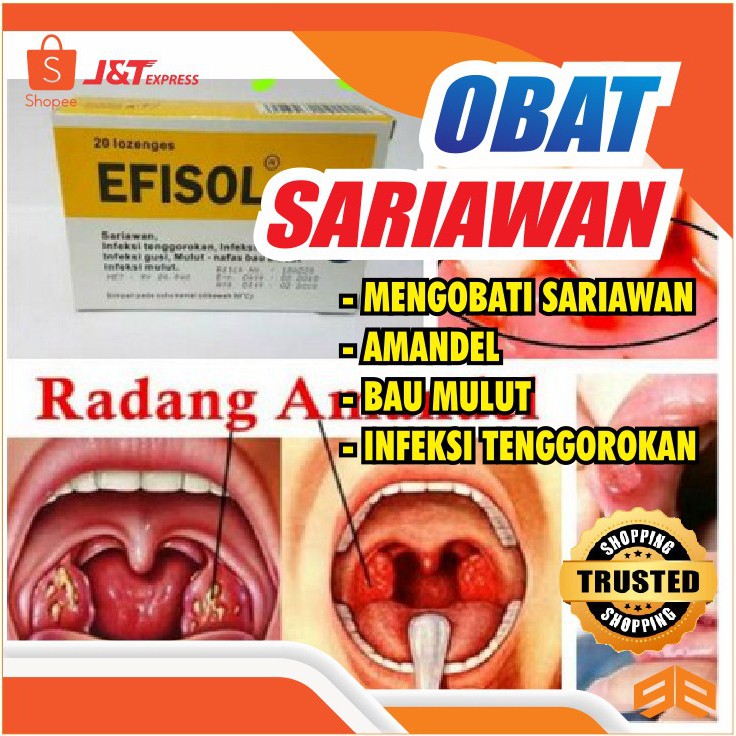 Efisol 20 Lozenges Obat Sariawan Infeksi Ternggorokan Amandel Gusi Bau Mulut Shopee Indonesia