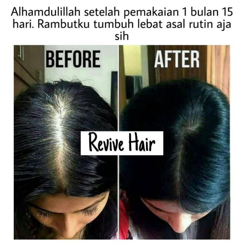 Penumbuh Rambut, Alis, Jenggot, Jambang, Bulu Dada Penebal Rambut Bayi &amp; Dewasa, Brewok, Kumis, Jambang, Janggut, Alis, Serum Penumbuh Rambut &amp; Pemanjang Rambut Tercepat Hair Tonic