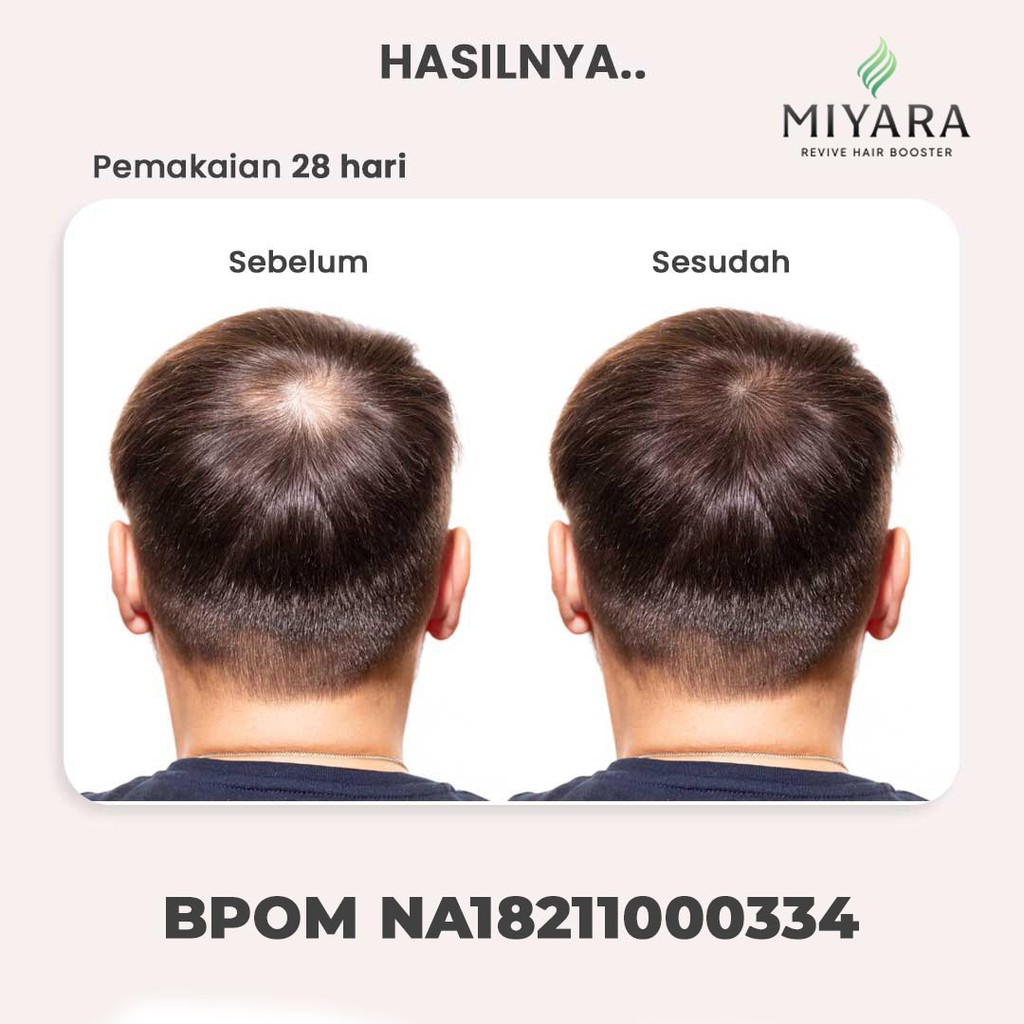 ORIGINAL MIYARA THICK HAIR TONIC - PERAWATAN RAMBUT RONTOK PENUMBUH RAMBUT &amp; VITAMIN RAMBUT