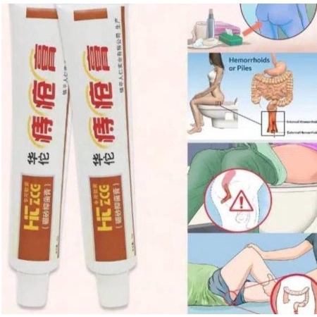 Huatou Dictamni Obat Wasir Ampuh Ambeien Ambeyen Salep Herbal Cina - Salep Wasir