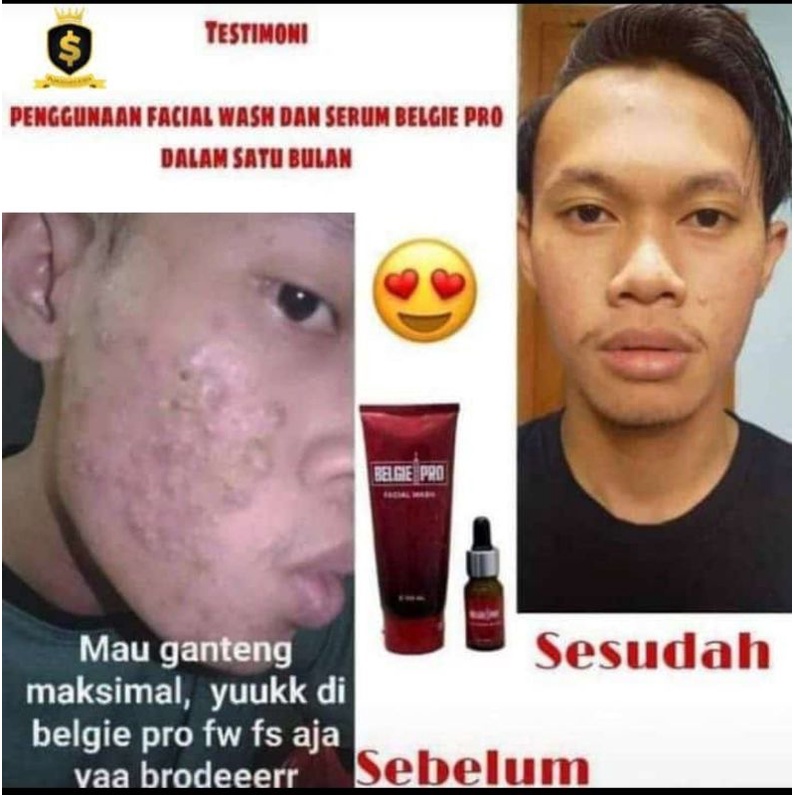 Serum Belgie Pro