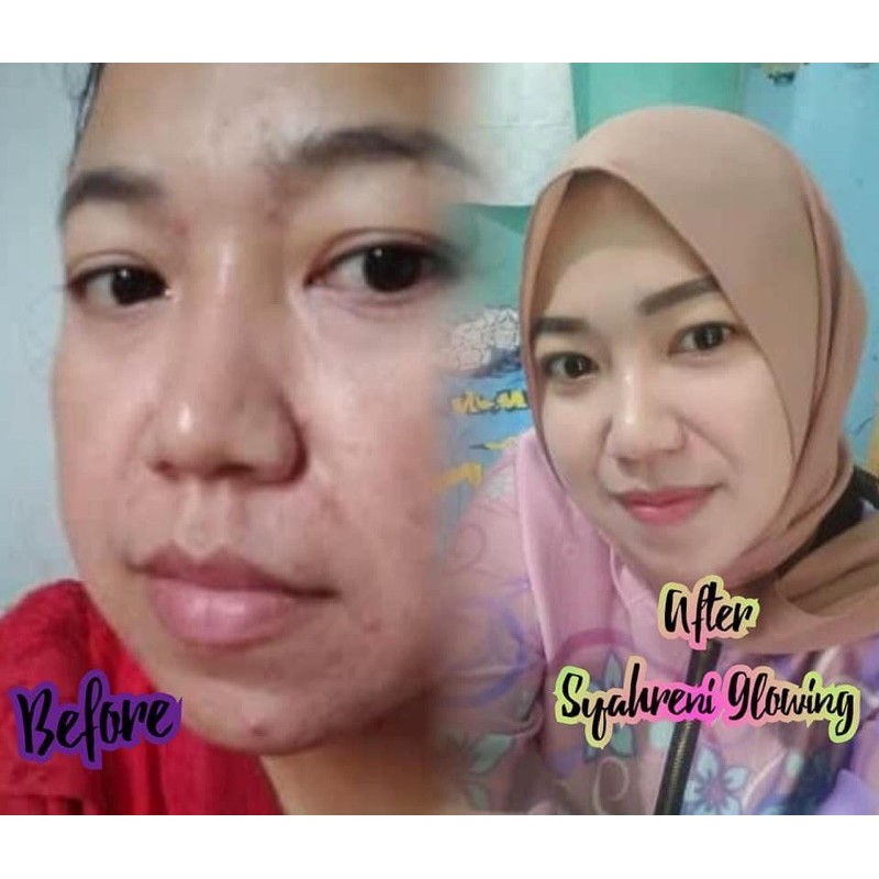 BISA (COD) SYAHRENI GLOWING PAKET LENGKAP / SYR GLOWING PAKET LENGKAP ORIGINAL