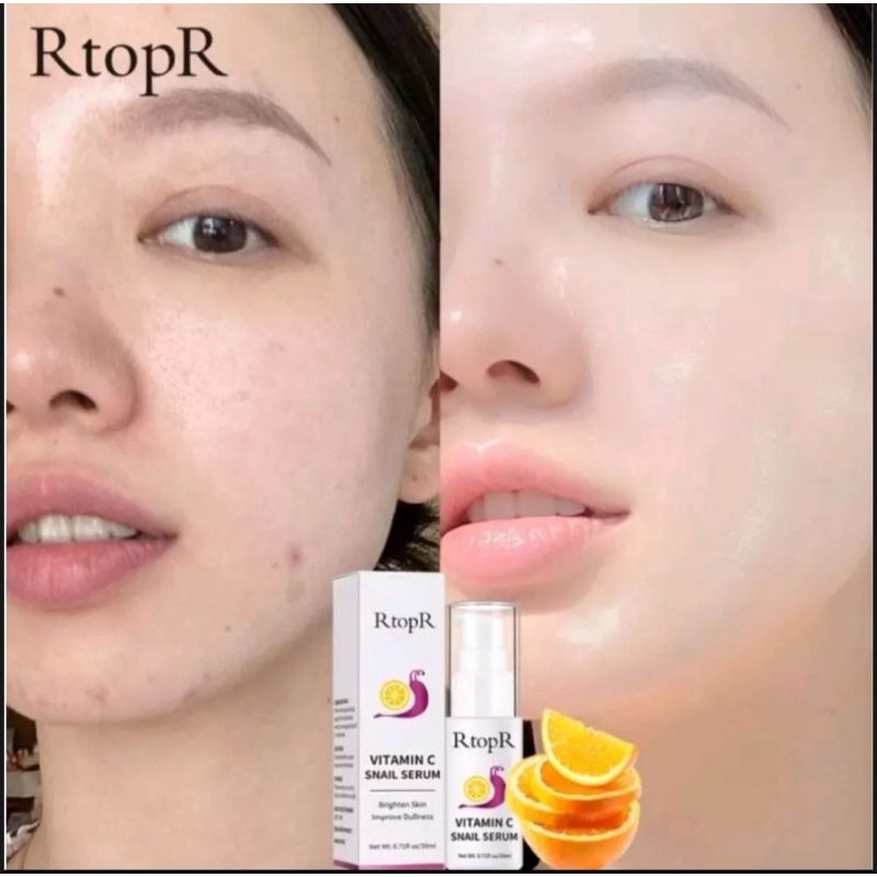 RTOPR VITAMIN C SNAIL SERUM MENCERAHKAN MEMUTIHKAN WAJAH - VITAMIN C WAJAH