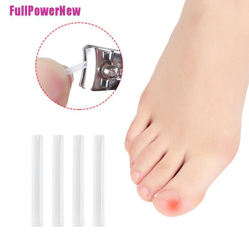 [Full] 10pcs Toenail Straightening Clip Ingrown Toenail Correction Nail Patch Sticker