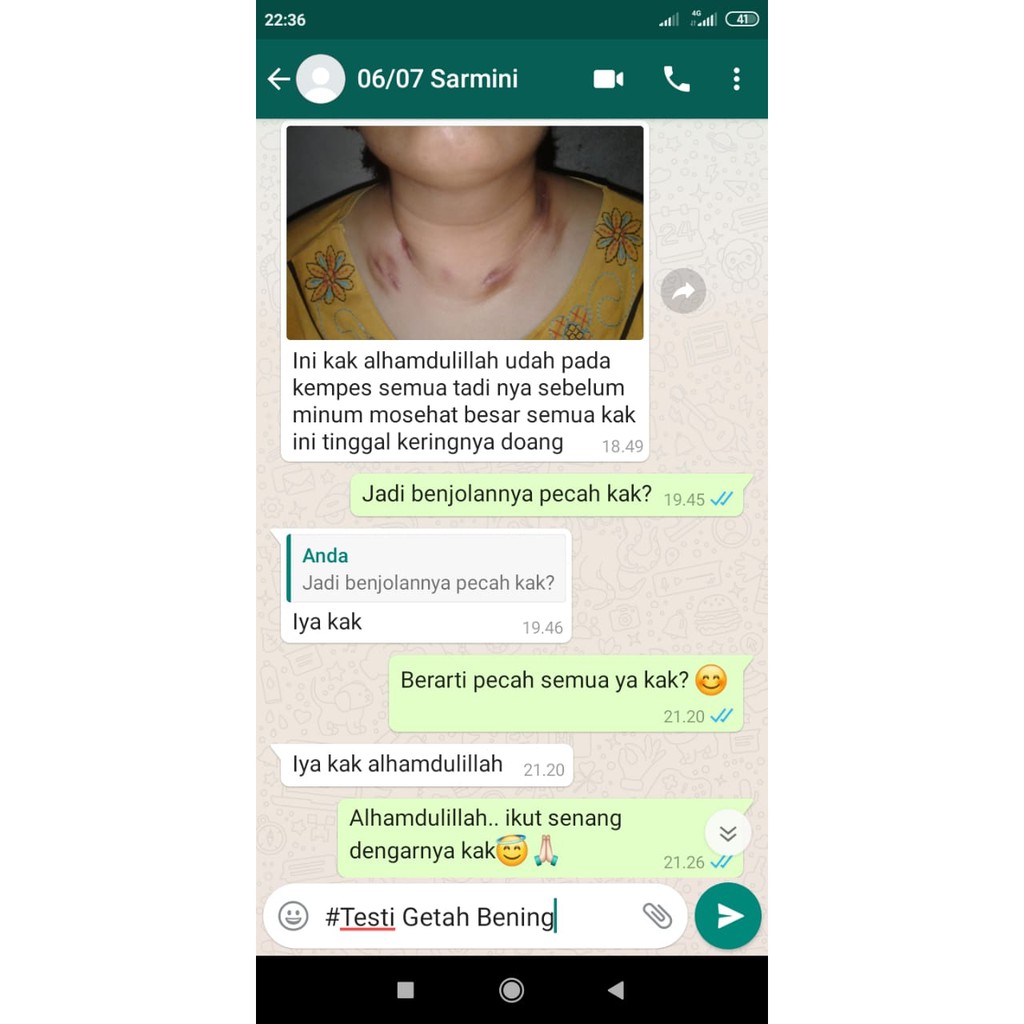 MOSEHAT  30 ML OBAT HERBAL ORIGINAL-6