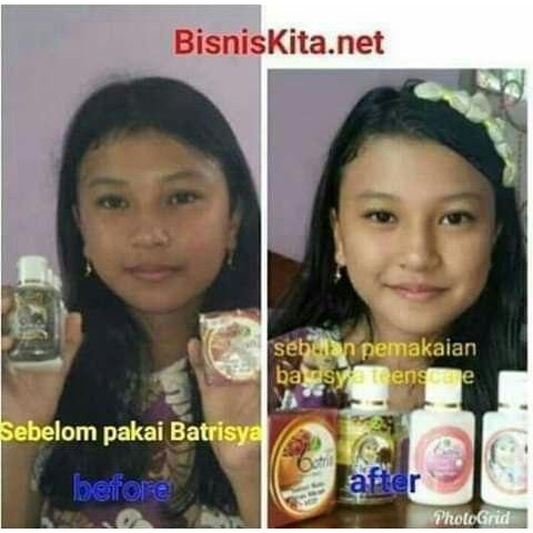 Day &amp; Night Cream Teens care Batrisyia