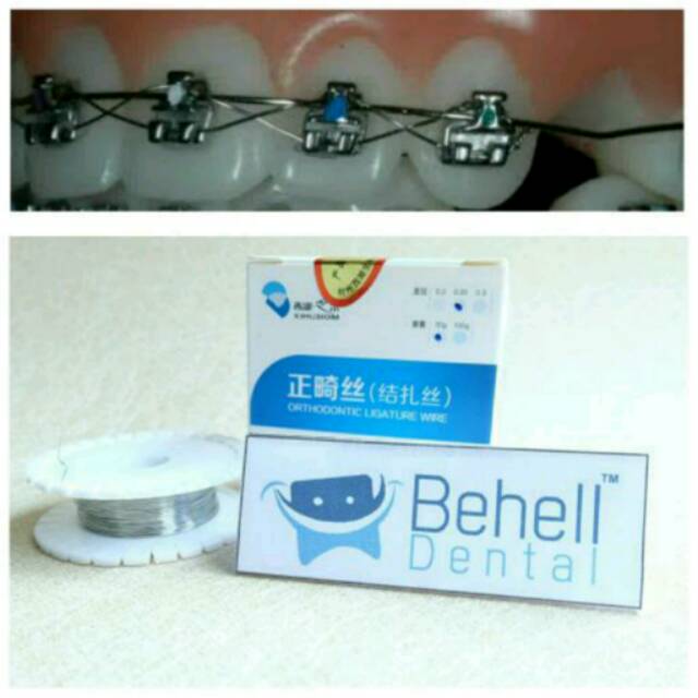 ORIGINAL LIGATURE WIRE DENTAL BRACES // Kawat Lilit Behel Gigi // Kawat Ortho Untuk Perbaikan Gigi Per Roll / Gulung 30 Gram 0.25 020 0.30 // Anti Karat behelldental