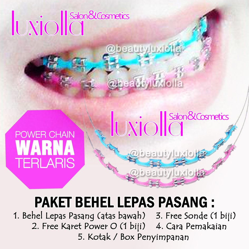 Warna Karet Behel Power Chain Yang Lagi Trend Ide Perpaduan Warna