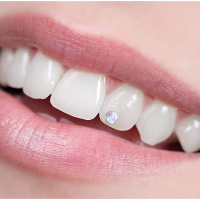 Berlian gigi / Diamond teeth