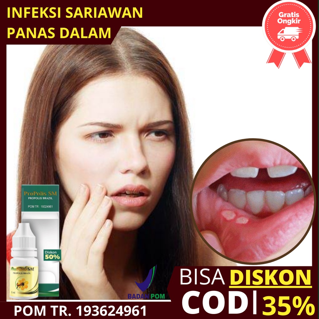 Obat Lidah Gusi Bengkak