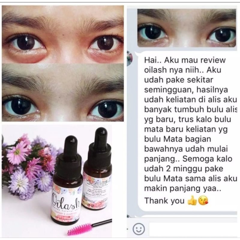 SERUM PENUMBUH BULU MATA OILAS MEMPERCANTIK BULU MATA MENGHITAMKAN BULU MATA DAN PELENTIK BULU MATA