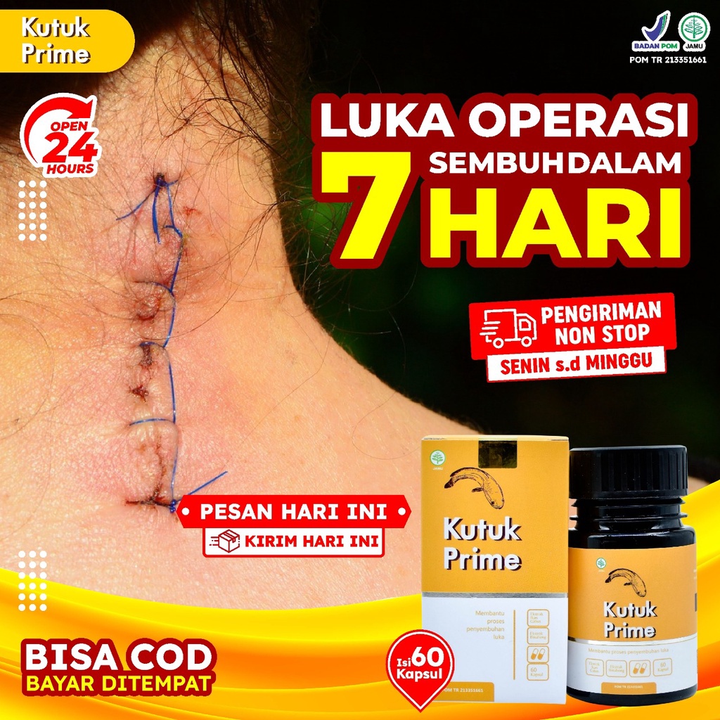 Kutuk Prime – Kutuk Kapsul Kutuk Prime 100% Ekstrak Ikan Gabus Atasi Luka Operasi Sembuhkan Diabetes Cepat Keringkan Luka Operasi Turunkan Kadar Gula Cegah Infeksi Pada Luka Cegah Keloid Atasi Luka Bakar Kecelakaan