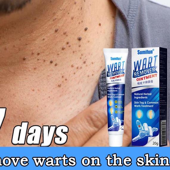 ♫ Warts Remover Cream Wart Treatment Skin Tags Mole Remover Plaster Cream Antibacterial Foot Wart Oi