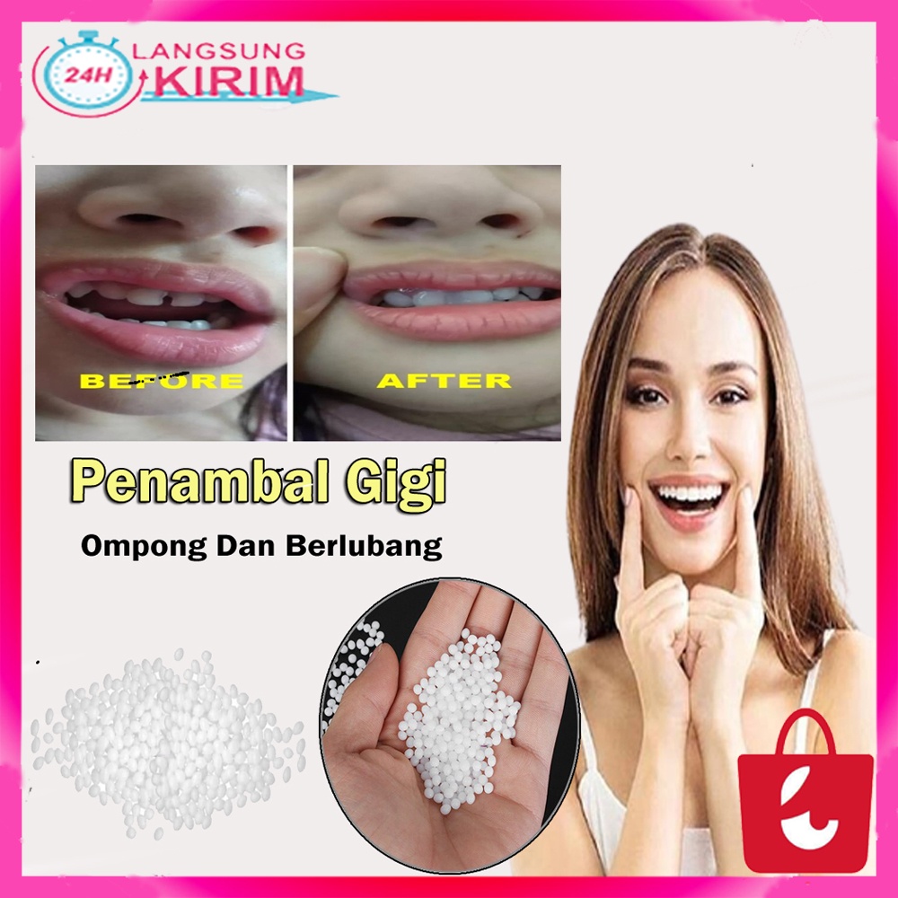 Jual 50 Butir 100 Asli Penambal Gigi Berlubang Super Kuat Penambal Penutup Gigi Ompong 1983