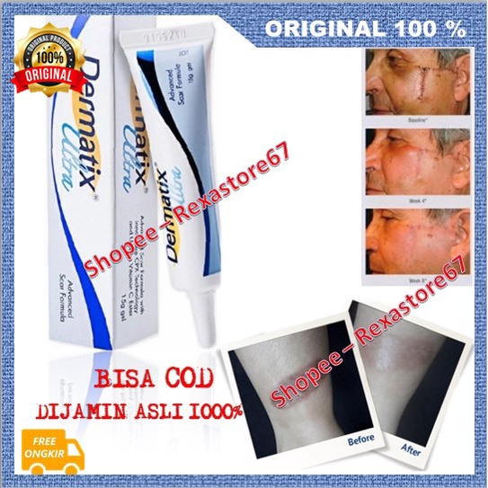 Dermatix Ultra Gel Penghilang Bekas Luka / Keloid ANTI SCAR Stretchmark Perbaikan Kulit Terbukti Amp